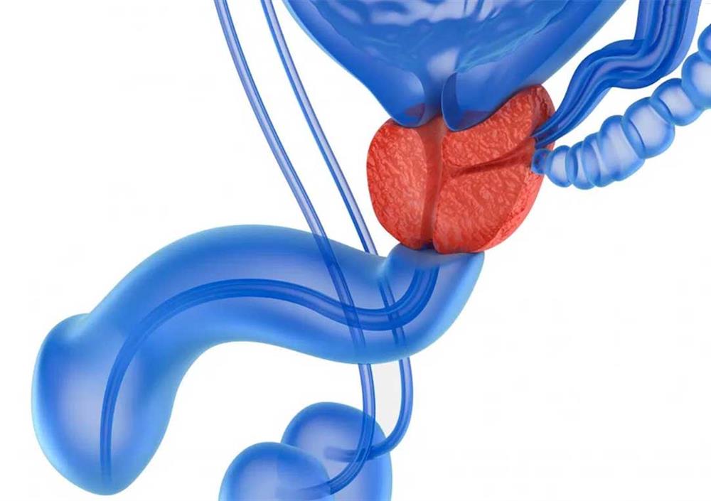 prostata modra